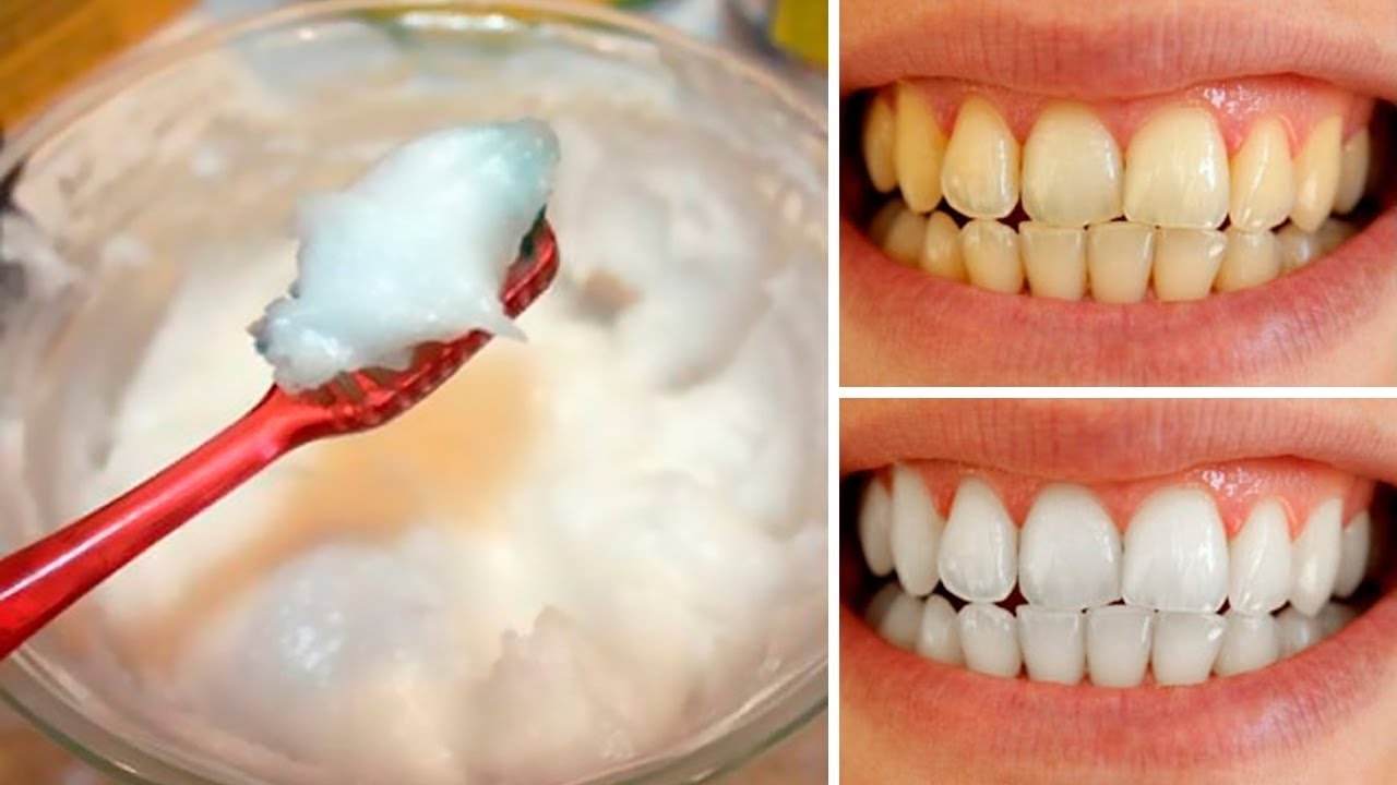 How to remove brown stains from teeth naturally